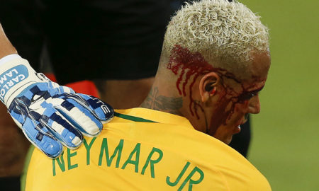 Neymar sangrando